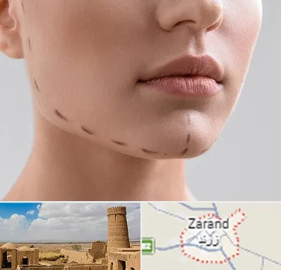 عمل زاویه فک در زرند