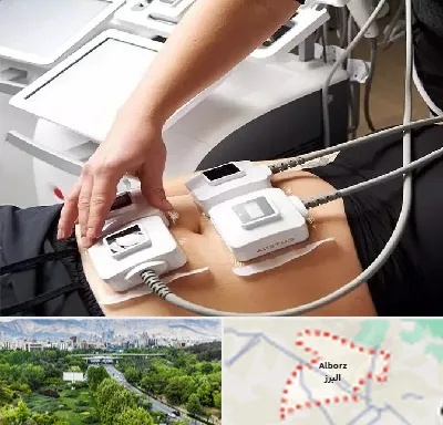 ترواسکالپ در البرز