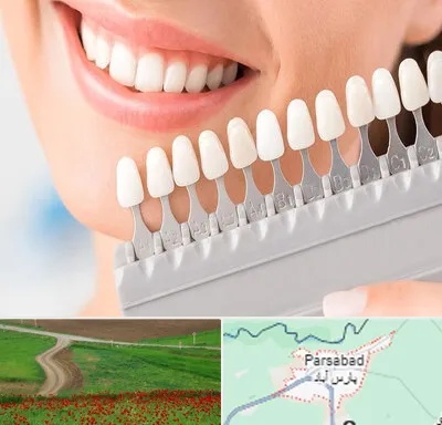 متخصص لمینت دندان در پارس آباد