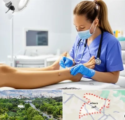 کارشناس زخم در البرز