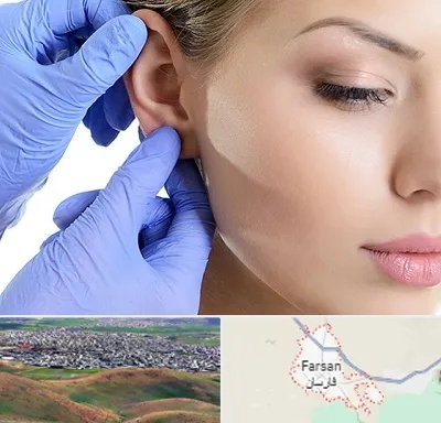 اتوپلاستی در فارسان