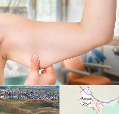 براکیوپلاستی در فارسان