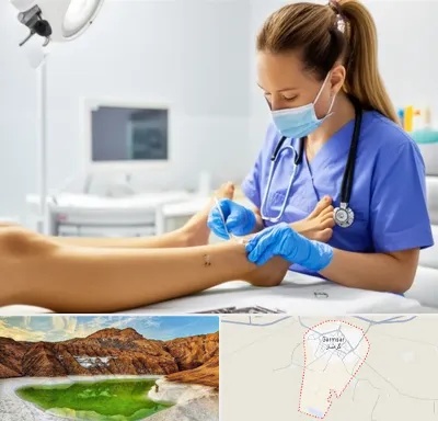 کارشناس زخم در گرمسار