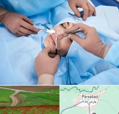 عمل بینی فانتزی در پارس آباد