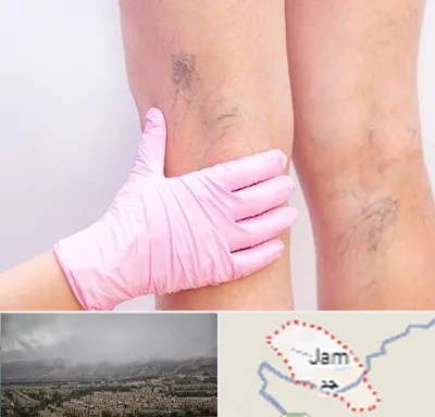 دکتر فوق تخصص واریس در جم