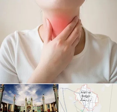 دکتر سرطان مری در آران و بیدگل