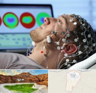 مرکز نوار مغز در گرمسار