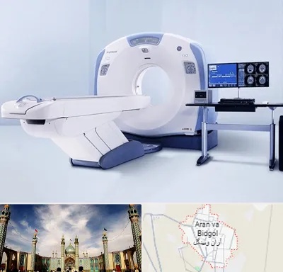سی تی اسکن شبانه روزی در آران و بیدگل