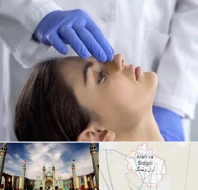 عمل بینی عروسکی در آران و بیدگل