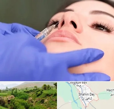هیالاز در شاهین دژ