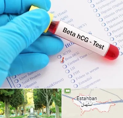 آزمایشگاه بارداری در استهبان