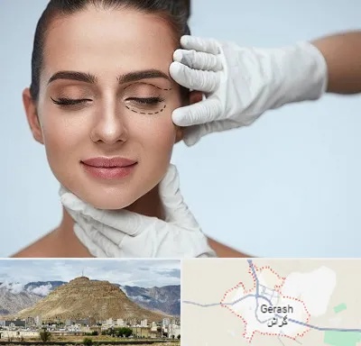 عمل پف چشم در گراش