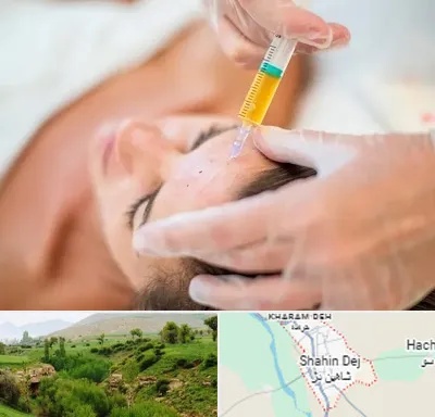 پی آر پی در شاهین دژ