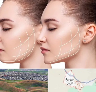 جراحی بوکال فت در فارسان