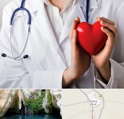 متخصص آریتمی قلب در خورموج