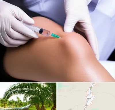 پلاسما درمانی PRP در کهنوج