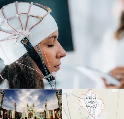 آزمایشگاه نقشه برداری مغز در آران و بیدگل