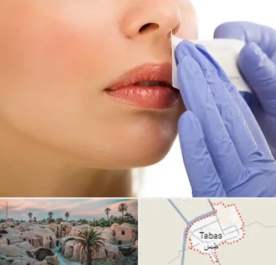 اپیلاسیون صورت در طبس