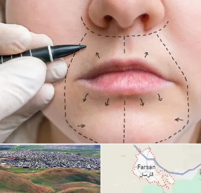 عمل سانترال لب در فارسان