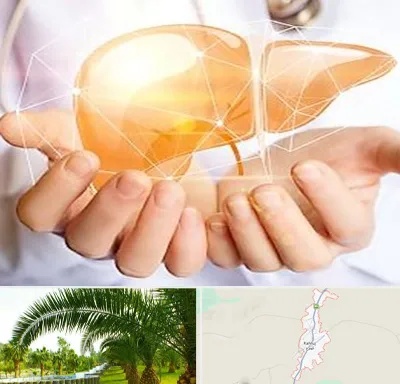 دکتر سرطان کبد در کهنوج