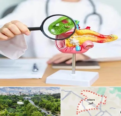 جراح سرطان پانکراس در البرز