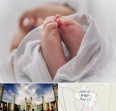 فوق تخصص تعیین جنسیت در آران و بیدگل