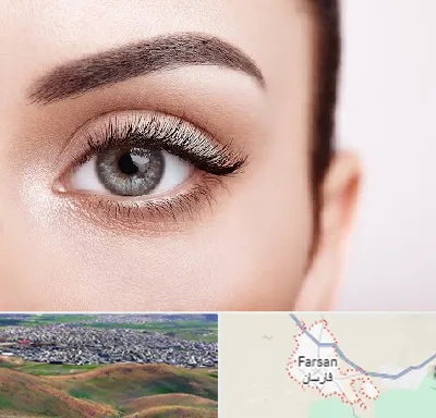 فوق تخصص عنبیه در فارسان