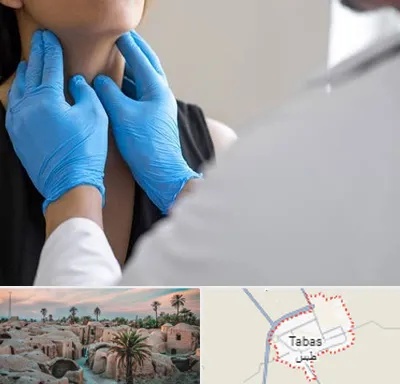 دکتر سرطان گلو در طبس
