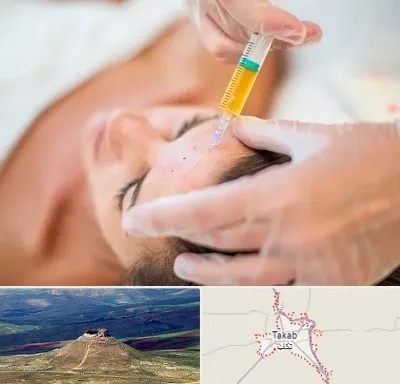 پی آر پی در تکاب