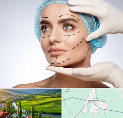 جراحی زیبایی در لشت نشا