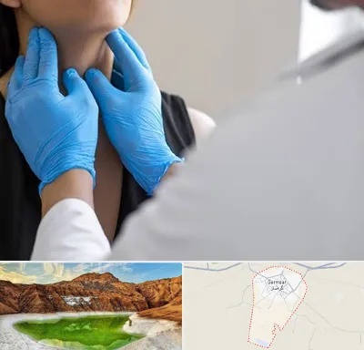 دکتر سرطان گلو در گرمسار
