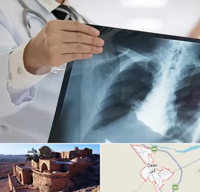 فوق تخصص ریه در قائن