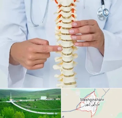 جراح ستون فقرات در مشگین شهر