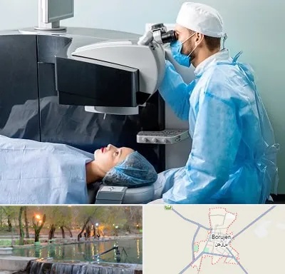 مرکز لیزیک چشم در بروجن