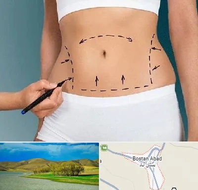 دکتر طب سنتی برای لاغری در بستان آباد