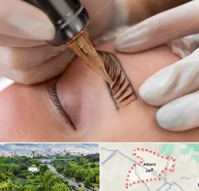 میکروبلیدینگ در البرز