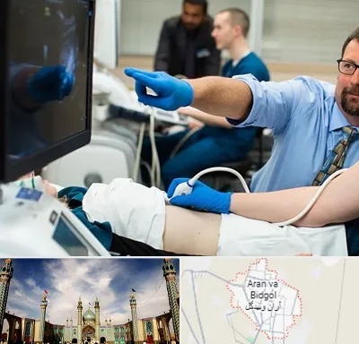 سونوگرافی شبانه روزی در آران و بیدگل