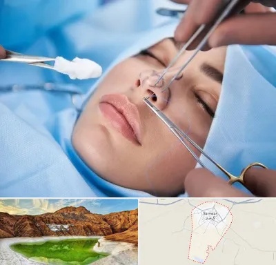 عمل ترمیمی بینی در گرمسار