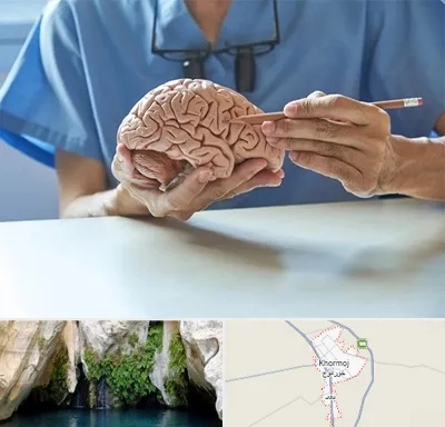 دکتر نورولوژی در خورموج