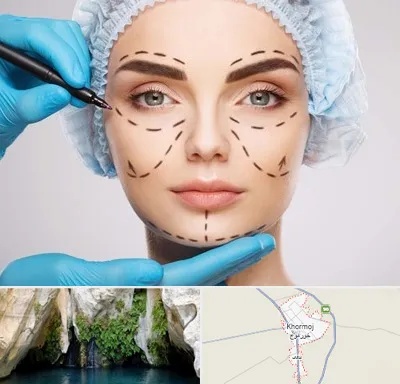 جراح پلاستیک در خورموج