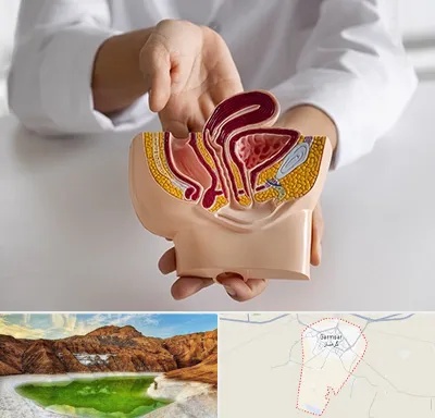 دکتر دستگاه تناسلی مردان در گرمسار