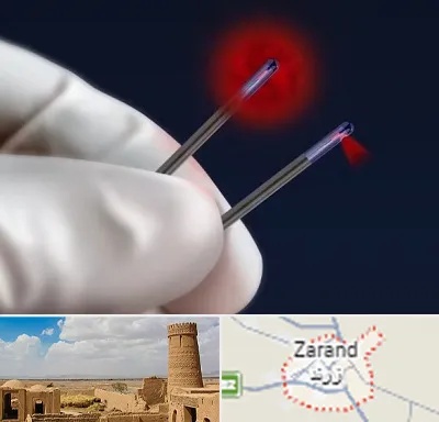 جراحی سینه با لیزر در زرند