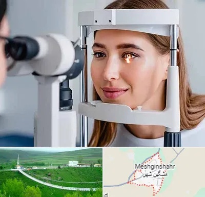 دکتر چشم پزشک خوب در مشگین شهر