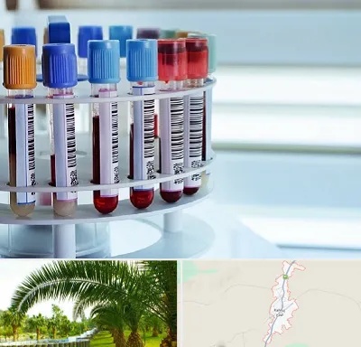 آزمایشگاه ژنتیک در کهنوج