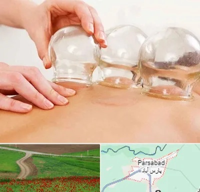 بادکش درمانی در پارس آباد