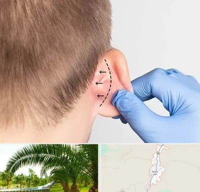 عمل زیبایی گوش در کهنوج