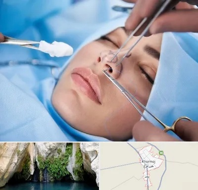 عمل ترمیمی بینی در خورموج