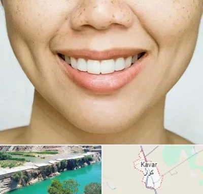 عمل چال گونه در کوار