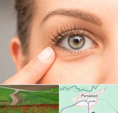 جراح پف چشم در پارس آباد