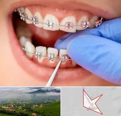 مرکز ارتودنسی دندان در خلخال